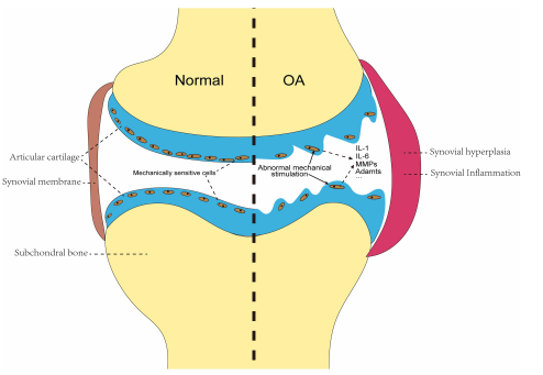 機(jī)械信號(hào)轉(zhuǎn)導(dǎo)：流體剪切力在骨關(guān)節(jié)炎發(fā)展中的關(guān)鍵作用